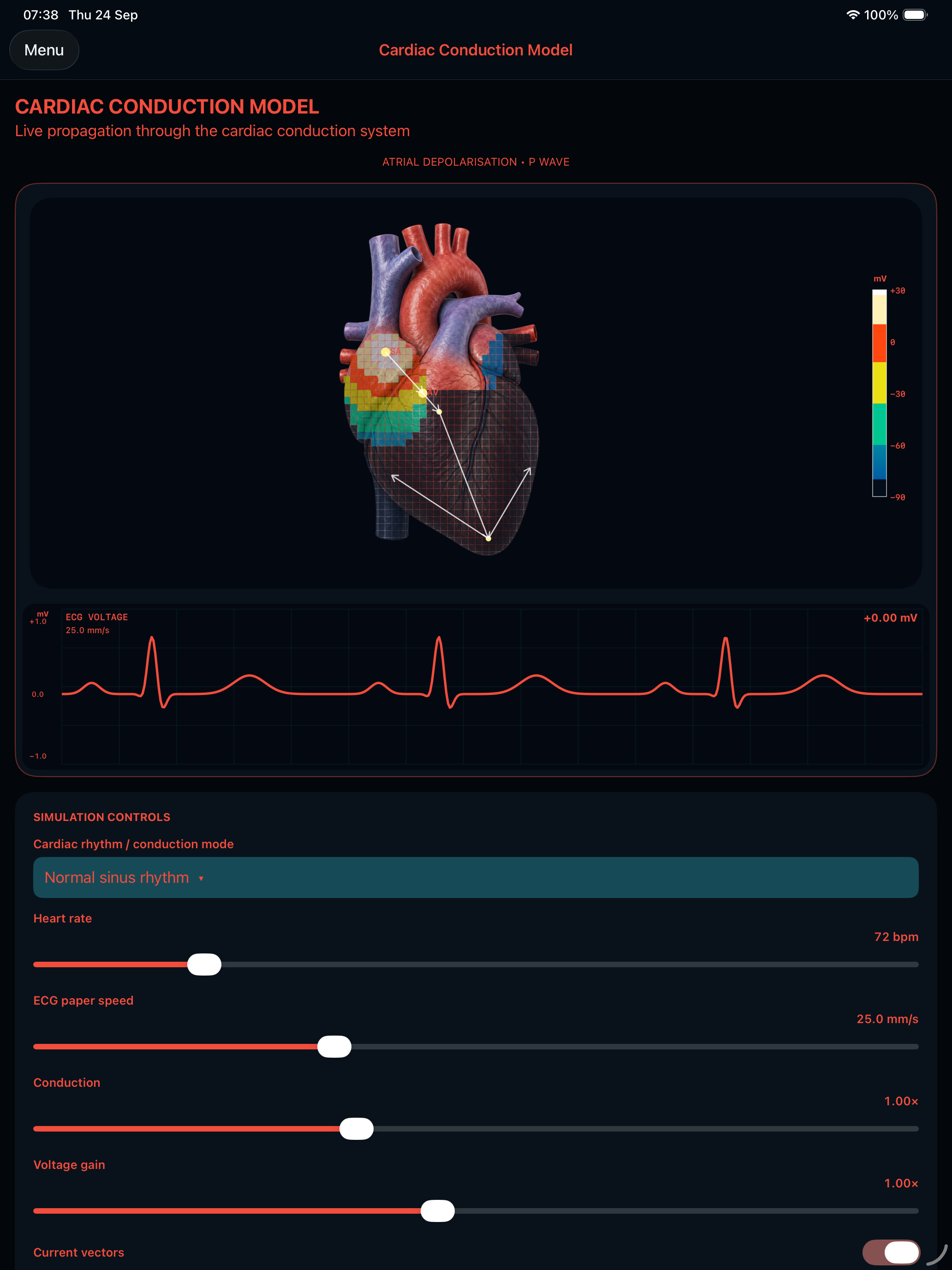 Integrated Physiology cardiac conduction model with a heart diagram and ECG trace